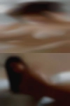 Naked girls with deformities